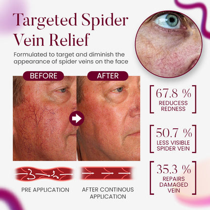 Seurico™ Facial Vein Soothing Repair Cream