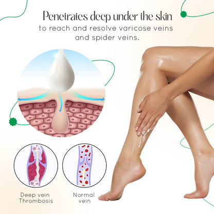 Seurico™ Varicose Vein Relief Cream🌿