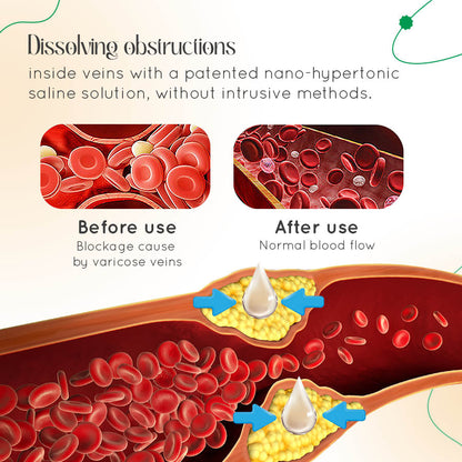 Seurico™ Varicose Vein Relief Cream🌿